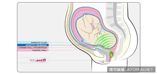 『Babypod』：能塞入陰道放音樂做胎教的好喇叭(?)