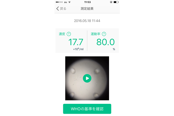 測量精子活動力不用去醫院了　這款 APP 讓你在家自己來