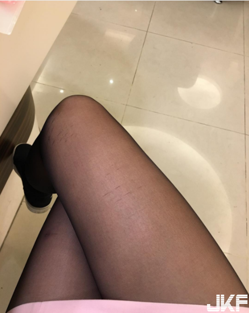 超狂！網友看牙醫驚見女助理「短裙露內褲」牙齒整個不痛了！女助理私底下上班超狂的