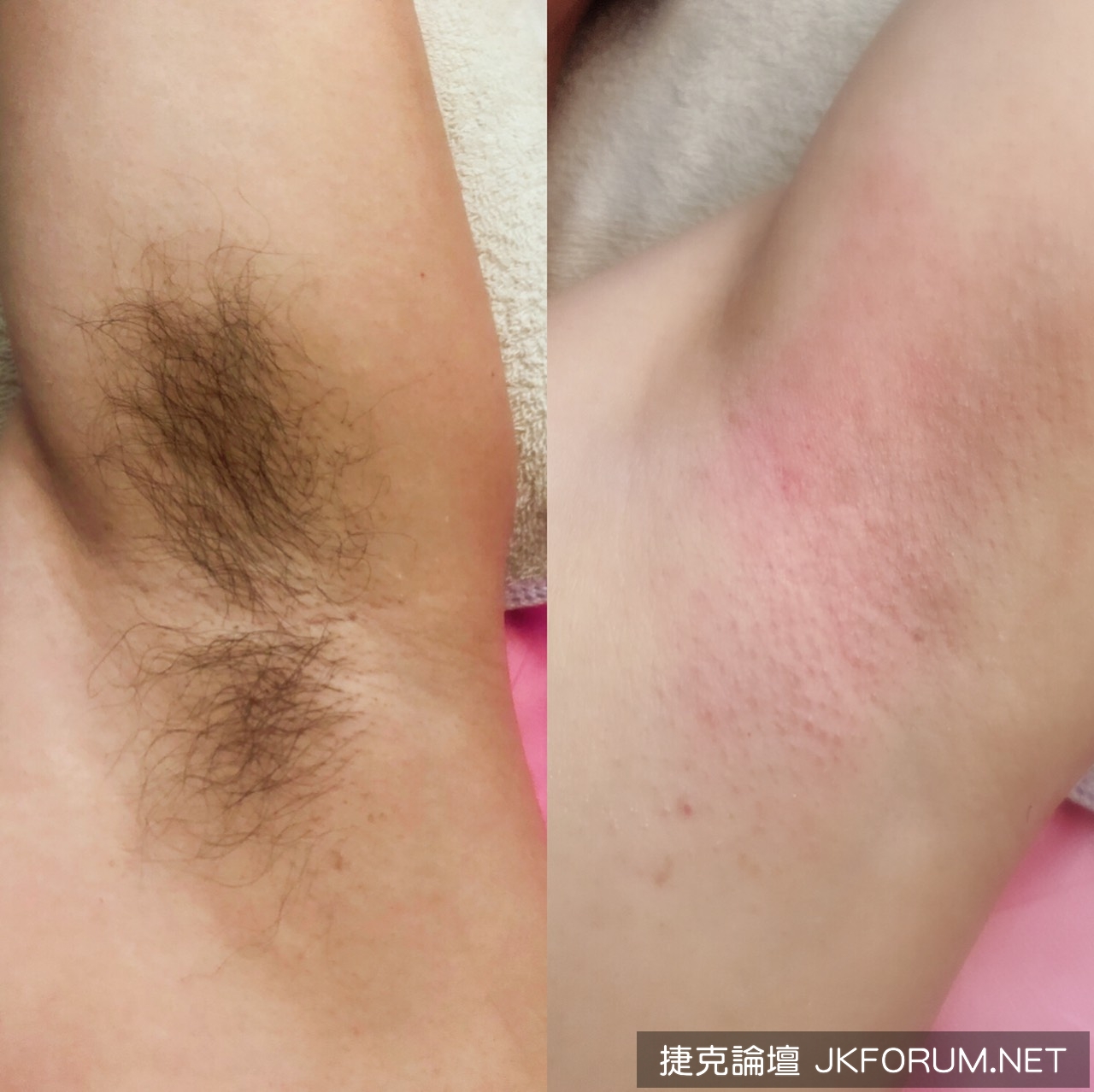 大台北 專業思秘除毛加line諮詢 台灣女生 讓你無時無刻都乾淨 按摩 指油壓 理容 捷克論壇
