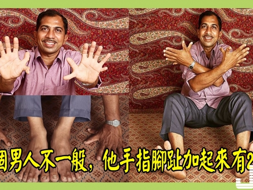 這個男人不一般，他手指腳趾加起來有28根