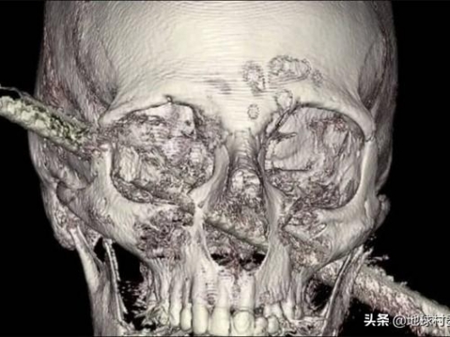 死神也會迷路，除去生死所有的意外都是小事
