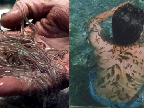 一名男子想要利用鰻魚吃掉自己腳上壞死的皮膚組織，不過最終這些小鰻魚進入了他的腎...