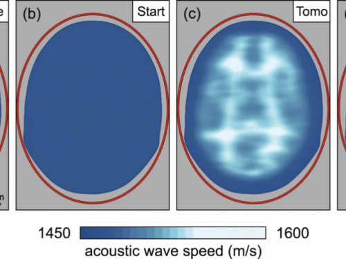 比 MRI 輕便、適用，科學家用預測地震技術打造新型人腦成像概念