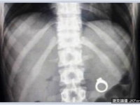 幹嘛拿出來？我差一點就能消化它們了