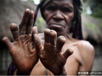 死一人斷一指！　印尼丹尼族人用「鮮血」悼念死者
