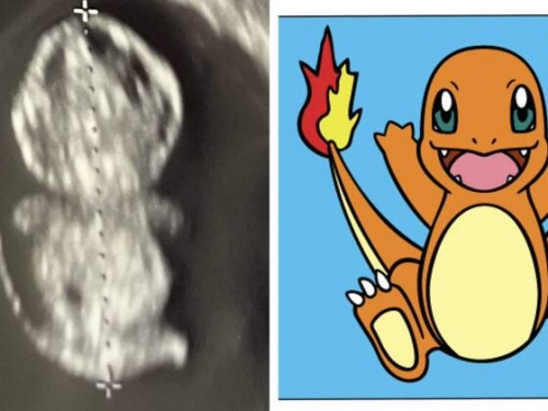 產檢超音波照「出現小火龍」 寶可夢迷驚呼：親媽是噴火龍嗎？