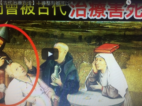 8個令你懷疑人生的【古代治療方法】！連整形都可以