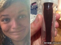 意外的紀念品...　英女遊越南　吸入8公分「胖水蛭」