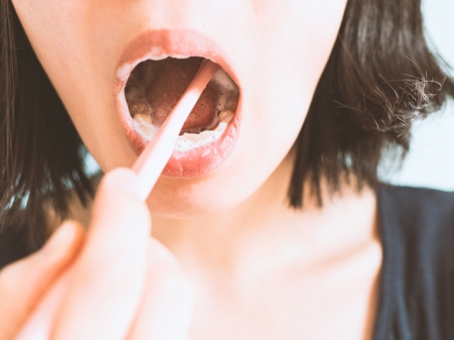 古人沒牙刷從不刷牙？誤會大了 靠日常2物護齒