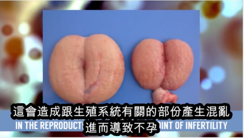 10個濫用類固醇的最糟副作用