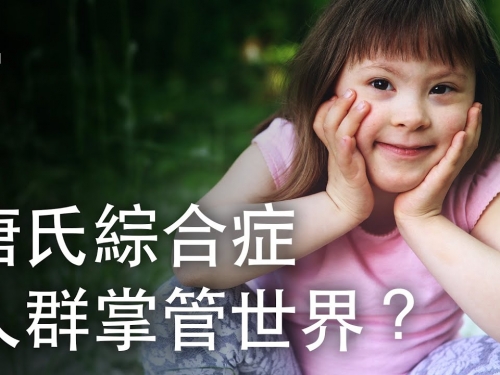 如果唐氏綜合症人群掌管了世界？| 大膽科學