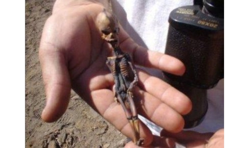 古今中外小矮人真實記錄(下)