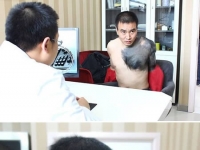 10個全世界最驚奇的天生胎記。是進化還是突變？
