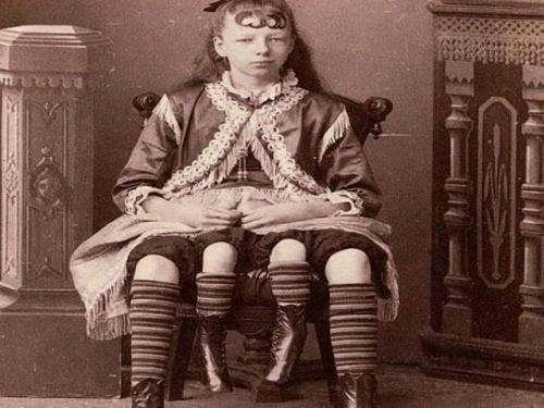 天生有四條腿的奇女子，坐著就能賺錢，死後墓地被子女蓋上混凝土