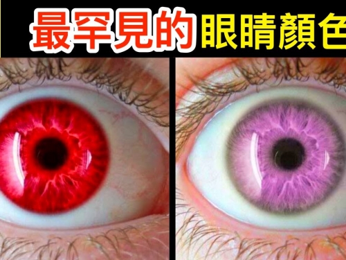 世界上最罕見的眼睛顏色！