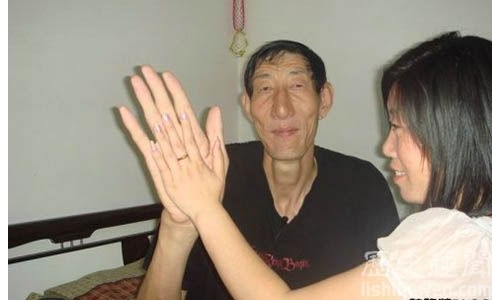 世界上最長的手指究竟有多長?