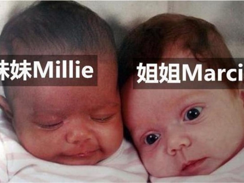 雙胞胎姐妹相貌不一，被人調侃“奧利奧姐妹”，如今變成什麼樣了