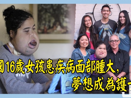 美國16歲女孩患疾病面部腫大，夢想成為護士！