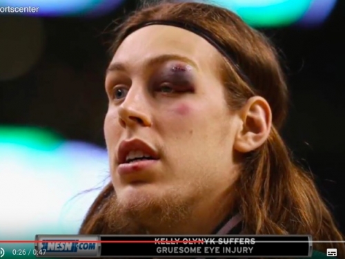 [影]「分筋錯骨手」再現！騎粉看到綠衫軍中鋒這招一定氣瘋......