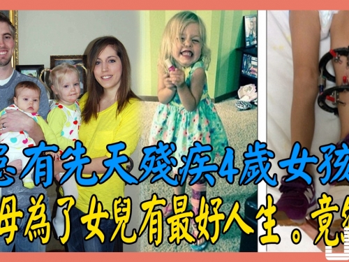 4歲女孩天生長短腿，為了女兒有最好人生，拒絶截肢建議的父母，忍痛採用斷骨增高術