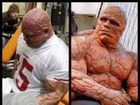 芬蘭壯漢頭部布滿褶皺　似「石頭人」引熱議