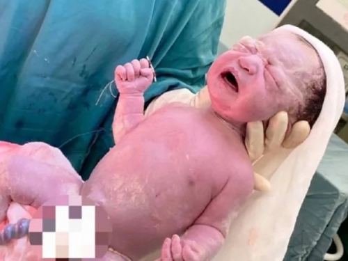 它抓不住我！越南醫院同日接生2名嬰兒 2母都裝有子宮內避孕器