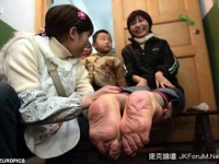 重慶奇女子雙腳倒長