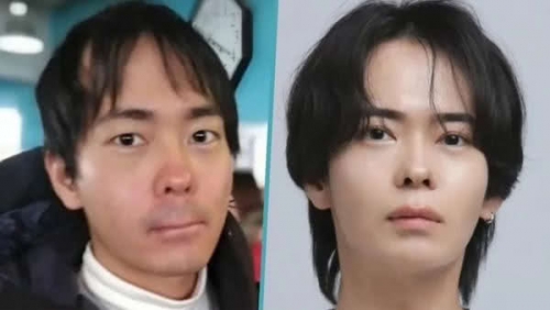 被笑禿頭還慘被分手！33歲日男10年大改造，外貌逆齡宛如凍齡 驚豔網友