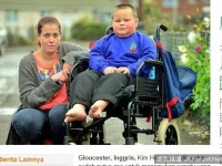 英國「裂足男孩」天生畸形　母盼大眾幫他找鞋穿