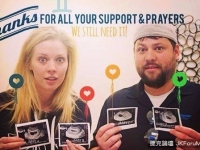 美少婦一次懷2對雙胞胎　醫師：機率僅7000萬分之一