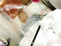 四川「賭氣哥」怒吞17公分鉛筆　5年後「完整」取出