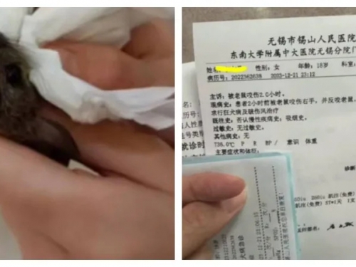女大生被老鼠咬到手氣炸竟「反咬老鼠頭」 網喊：是個狠人
