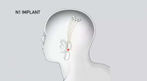 馬斯克將在 2020 年內發表 Neuralink 腦機介面技術