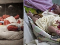 人間罕見至極案例！　95%男性的陰陽人生下龍鳳胎