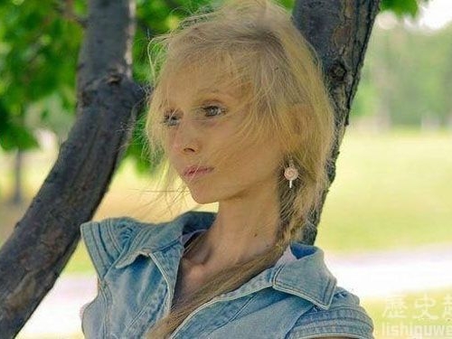 世界上最瘦的人：世界上最瘦的三個女孩