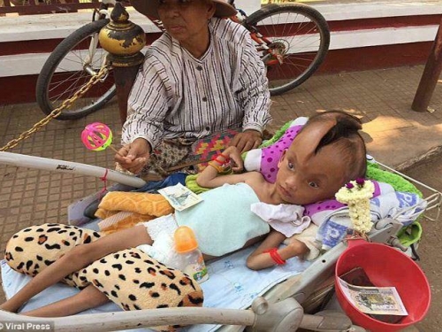 男童頭顱上10公分裂縫越長越大 整隻手還能伸進去