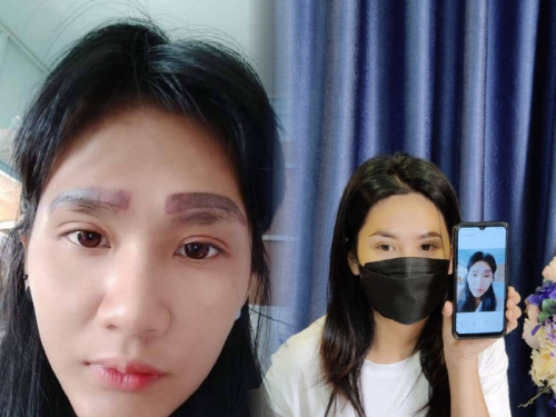 慘！到美容診所霧眉 她一覺醒來變「4條眉毛」