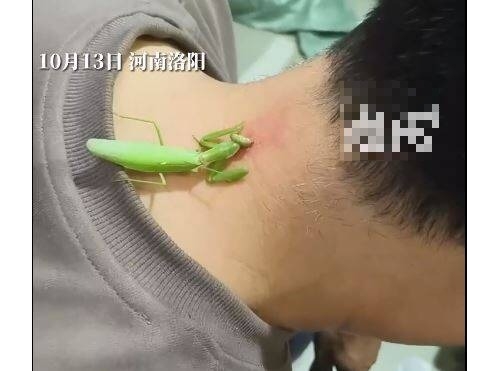男子頸後長病毒疣 竟靠「螳螂」治療