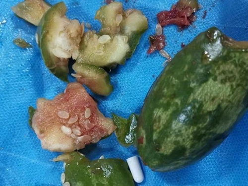 25歲男洗菜滑倒「整顆瓜爆菊入體」　網友笑噴：剛烈的漢子