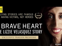 世界最醜女人 麗茲拍反霸淩片湧47萬粉絲