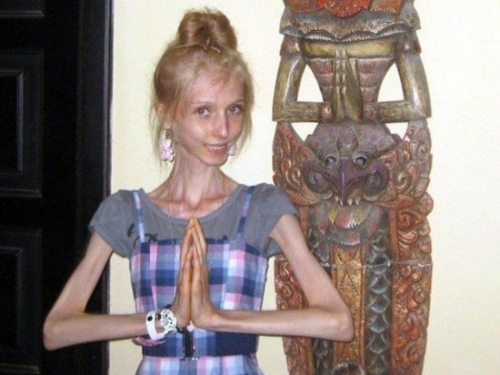 世界上最瘦的人有多瘦?