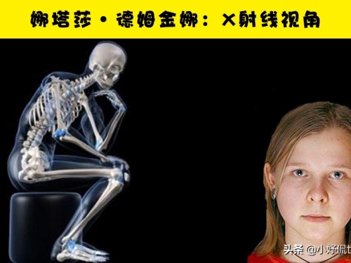 真實的“超能力”：盤點世界上的5個天生擁有特殊能力的人