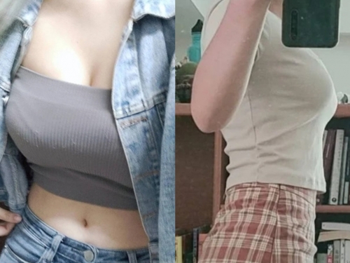 正妹7年不穿內衣 她曬「身材變化」驚呆網：跟天生有關