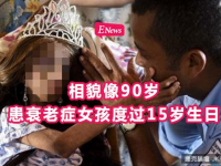 相貌像90歲患衰老症女孩度過15歲生日