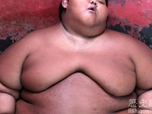 世界上最重的男孩：除了吃就是睡胖到無法呼吸