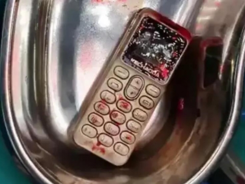 吵架不能輸！印度女為吵贏哥哥「吞下手機」