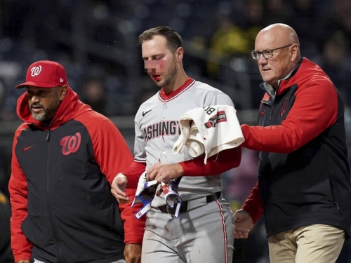 MLB》恐怖！被149公里速球K中臉部 國民德容濺血讓隊友嚇壞
