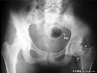 小菊花的驚人容量，婀..這嚇不倒我的