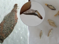 原以為「牠」只是棉絮，沒想到會爬、啃毛，還越長越多！根除這「怪物」一定要做到「這點」！